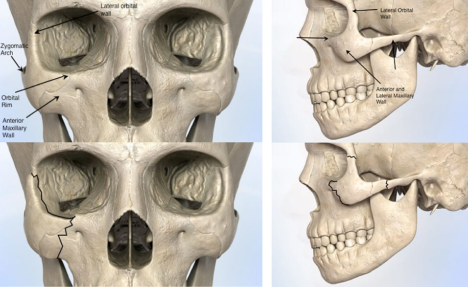 Facial injuries photos