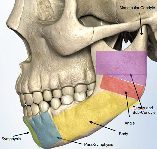 Jaw Reconstrucion Problems After Broken Jaw